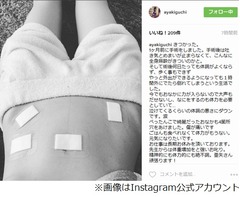 木口亜矢告白「手術でおなかに4か所穴開けた」