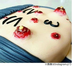 なぜ作った&hellip;ニキビ潰しケーキ