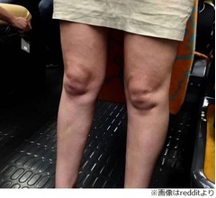 「女性の脚をね、ジーッと見てたんですよ&hellip;&hellip;そしたら」