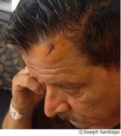 銃弾が頭に&ldquo;命中&rdquo;も跳ね返る、「信じがたいケース」と警察も驚き。