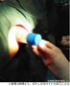 肛門に&ldquo;液体のり&rdquo;挿入し抜けず、医師「のりが漏れなくて良かった」。