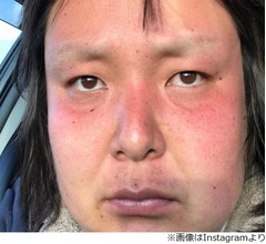 ガリガリガリクソンのまゆ毛消滅、「誰？」の声