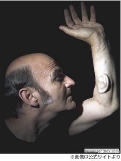 腕に&ldquo;第3の耳&rdquo;を作った男性、ネットに繋ぎ「他の場所でも聞こえる」。