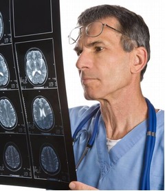 &ldquo;兄弟が脳卒中&rdquo;自身も危険増、55歳以下ではリスクが約2倍に。