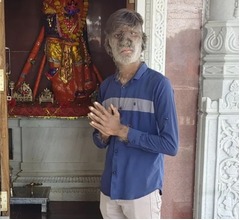 世界で数人&ldquo;オオカミ症候群&rdquo;の少年、ユニークな自分と生きる