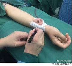 腕で&ldquo;育てた&rdquo;耳を頭部へ移植