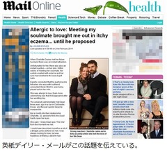 大好きなのに&ldquo;愛&rdquo;アレルギー、恋人への感情がたかぶると目が腫れる。