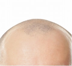 ロック様ら抑え&hellip;&ldquo;世界で最もセクシーな薄毛男性&rdquo;今年の1位は？