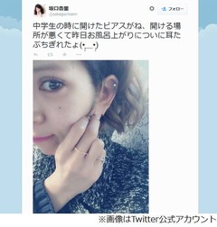 坂口杏里の耳たぶがちぎれる、公開された写真にファンから心配の声。