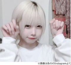 あの、金髪にした理由が「この規模の金髪だったとはみんな思わなかっただろうね」