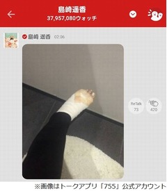 ぱるるが左足火傷で痛々しい姿「歩くの痛くてもーめげないっ」。