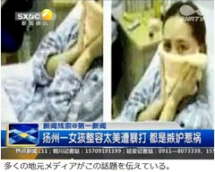 &ldquo;綺麗すぎる整形&rdquo;で殴られる、自身の手術に不満持つ女性の犯行か。