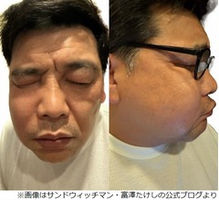 上白石萌歌、&ldquo;サンド富澤の顔パンパン&rdquo;副鼻腔炎に「実は私もなったことがありまして」