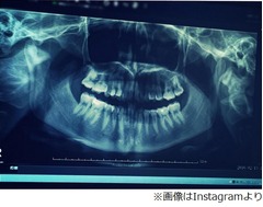 「衝撃の事実」菜々緒は出っ歯、ファンも「まさかの（笑）」と驚きの声。