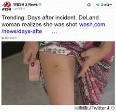 なんか痛い&hellip;5日後に撃たれてると判明、被害女性「バカに銃持たせるな」。