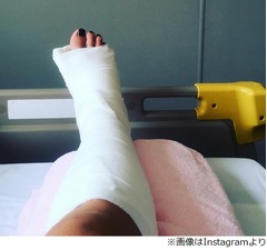 道端アンジェリカが転倒し骨折、手術へ