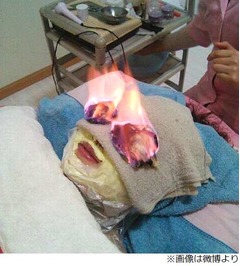 火使う&ldquo;目もとエステ&rdquo;に衝撃、専門家からは「危険すぎる」の声。