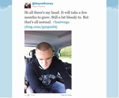ルーニー選手が植毛写真を公開、80万人のTwitterフォロワーとの約束守る。