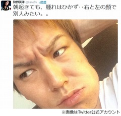 狩野英孝、左頬腫れ「左右の顔が別人」