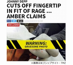 ジョニー・デップが夫婦喧嘩で指先失っていた