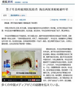 耳の中で&ldquo;蠢く物体&rdquo;の正体は、寝ている間にムカデ侵入で痛み。