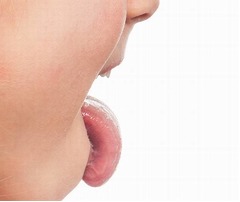 瓶の中に女児の舌ぴったんこ、医師も助けられず消防隊出動の騒ぎに。