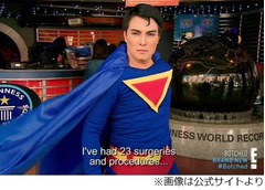 &ldquo;スーパーマンになりたい男&rdquo;24回目の整形手術でドクターストップ。