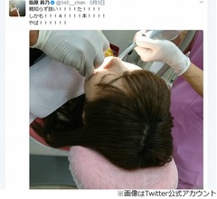 指原莉乃、多忙すぎて親知らず4本一気に抜く