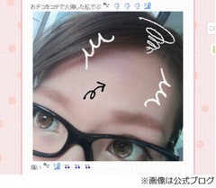 辻希美がおでこ火傷で悲しむ、皮むけ「スッピンだと殴られたみたい」。