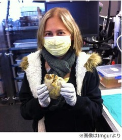 &ldquo;自分の心臓&rdquo;を手に持つ女性、心臓移植手術受け病気に打ち勝つ。