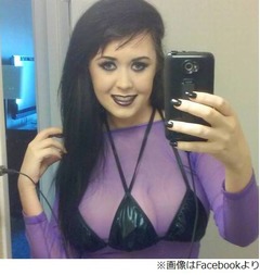 3つ目の乳房を手に入れた女性、医者を見つけるのが「本当に難しかった」。