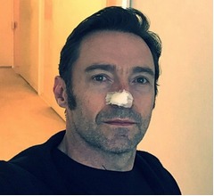 ヒュー・ジャックマン、新たながん発見
