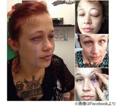 &ldquo;目にタトゥー&rdquo;が失敗、紫色の涙流し後悔