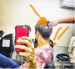 GACKTが2度目の円形脱毛症を告白