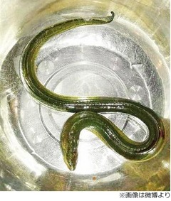 肛門からタウナギ侵入で腹痛に、見た目&ldquo;活き活きとした状態&rdquo;で摘出。