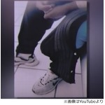 女性が恐れる&ldquo;世界一の巨根&rdquo;、生活にも影響しフルタイムで働けず。