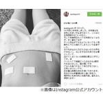 木口亜矢告白「手術でおなかに4か所穴開けた」
