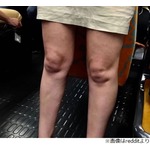 「女性の脚をね、ジーッと見てたんですよ&hellip;&hellip;そしたら」
