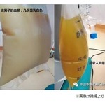 &ldquo;採血したら牛乳のような液体&rdquo;驚きの声も