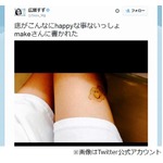 広瀬すず&ldquo;太もも&rdquo;写真が話題、ニコニコ顔のあざに「かわいい！」。