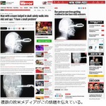 頭蓋骨にハサミが刺さった男、&ldquo;紳士的&rdquo;な振る舞いに病院スタッフ驚く。