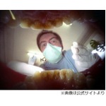 &ldquo;奥歯カメラ&rdquo;で日常の1コマを撮影、口の中から見えるのはどんな世界？