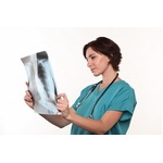 喫煙率低下で肺がん死大幅減、米国で1975〜2000年に&ldquo;劇的&rdquo;な変化。