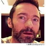 ヒュー・ジャックマンの皮膚がん再発、日焼け止め使用や定期検診呼びかけ。