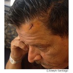 銃弾が頭に&ldquo;命中&rdquo;も跳ね返る、「信じがたいケース」と警察も驚き。