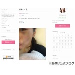 熊切あさ美の顔に大きなあざ「久しぶりに派手に転んじゃった」。