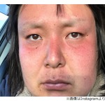 ガリガリガリクソンのまゆ毛消滅、「誰？」の声