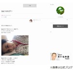 小林麻央、輸血や痛み止めで「息苦しさ軽減」