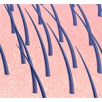 足に激痛、歩行困難の原因は&ldquo;1本の&hellip;&rdquo;