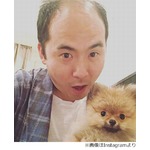 斎藤さんの髪の毛3000本抜ける、薄毛治療専門医が半年間の変化を解析。